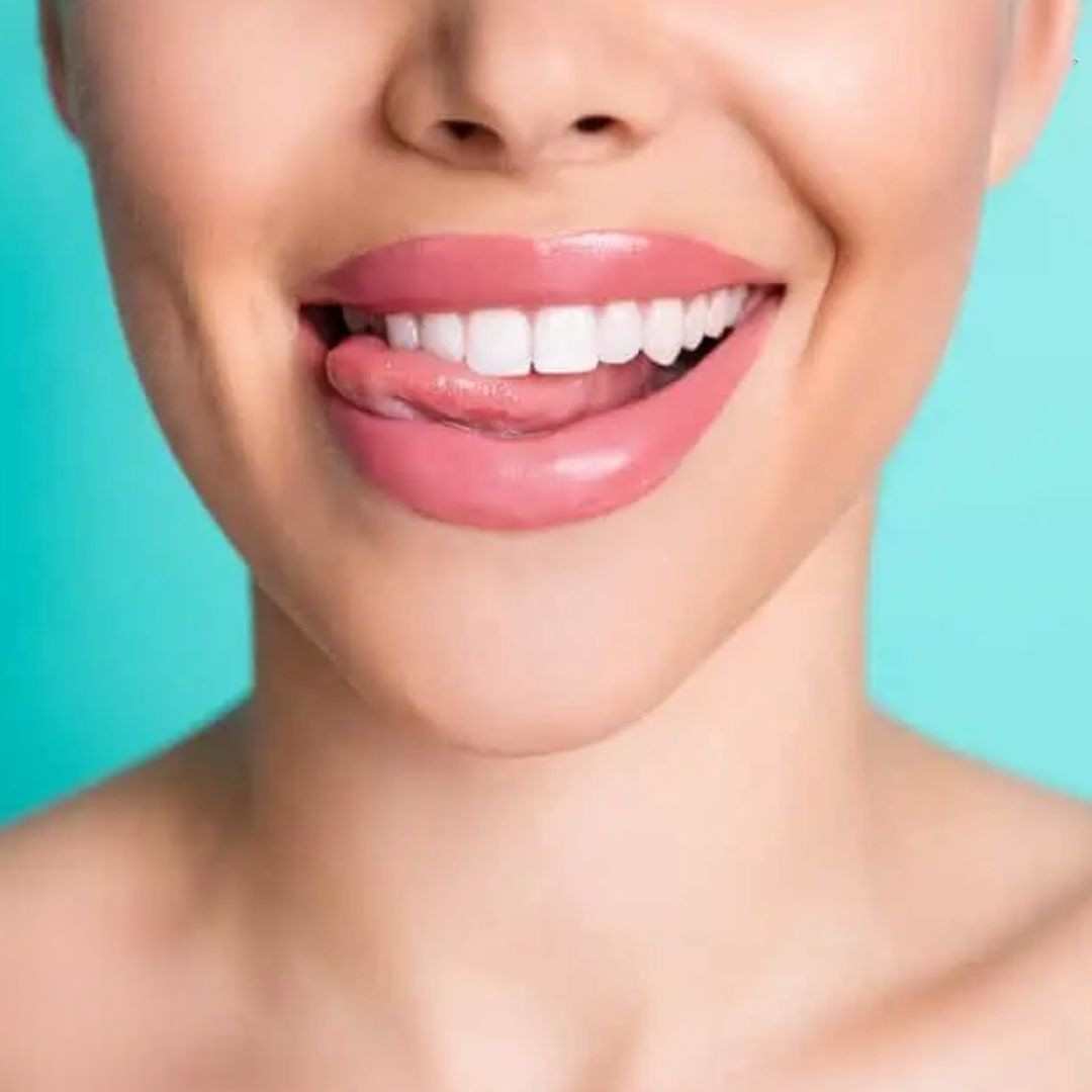 ToothPerfect™ | Get a perfect smile