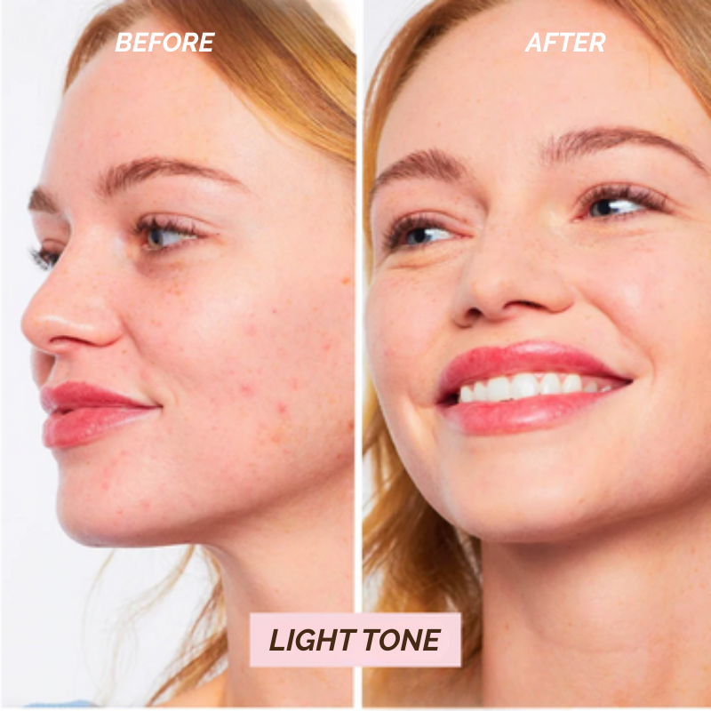 KGlow™ | Even tone, hide blemishes, and glow all day effortlessly!