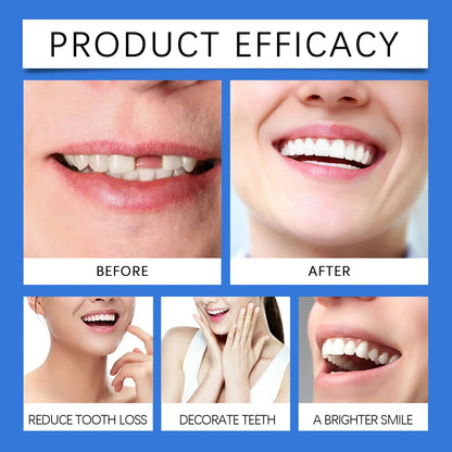 ToothPerfect™ | Get a perfect smile